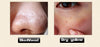 ROREC Hyaluronic Acid Ampoule Face Serum