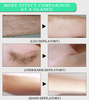 Unisex Herbal Hair Removal Cream