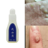 New Skin Tag Remover