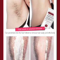 Fast Hair Removal Cream