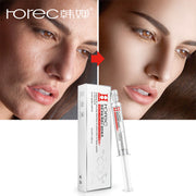 ROREC Hyaluronic Acid Injection Face Serum