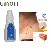 New Skin Tag Remover