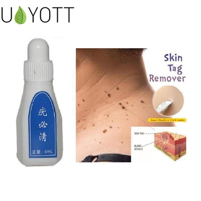 New Skin Tag Remover